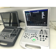 Clinic basic cardiac doppler ultrasound & LED monitor portable color doppler